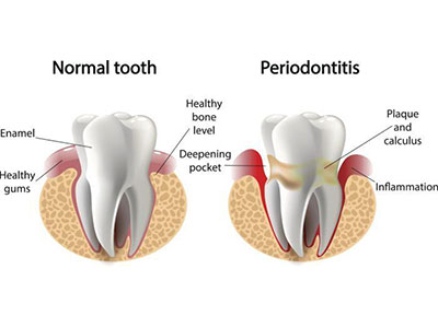 Best Dentist in Faridabad Near Me