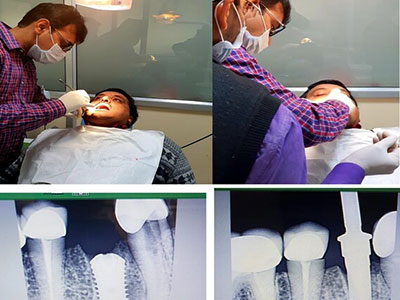 Best Dentist in Faridabad Near Me